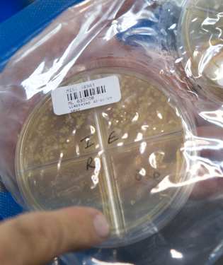 Photograph of a petri dish containing a TB sample.