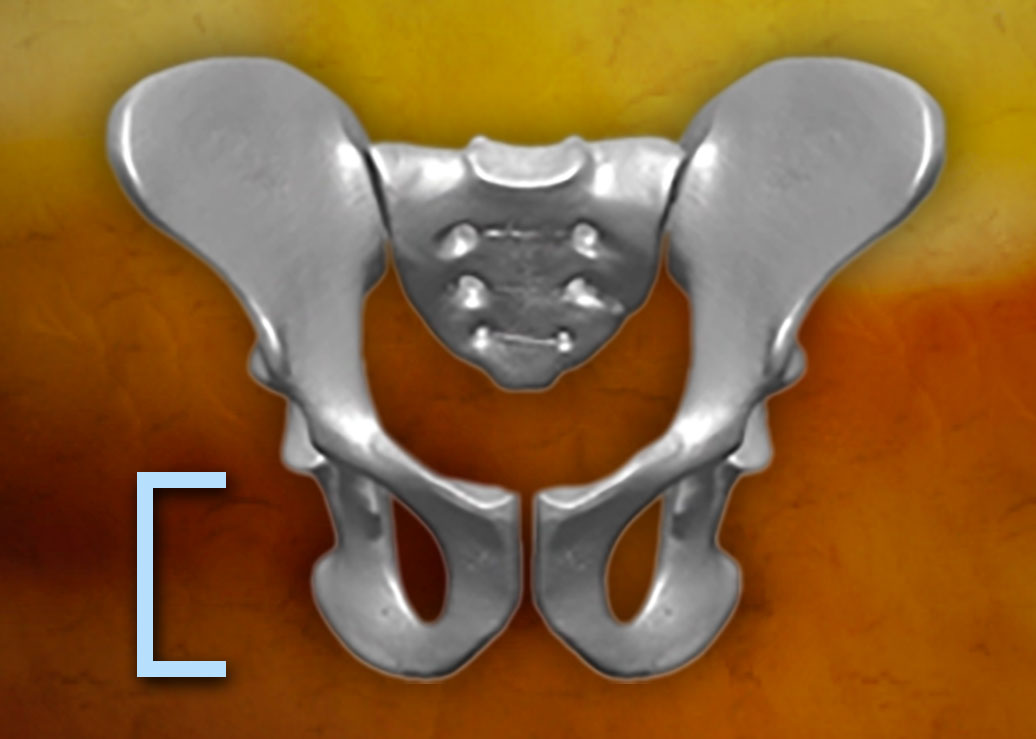 An Ardipithecus pelvis with a bracket alongside it marking the height of the ischium.
