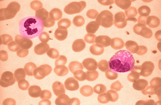 A microscope image of normal blood smear with two white blood cells.