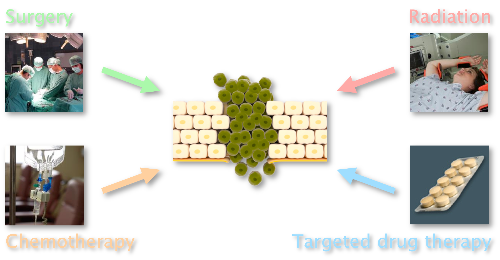 Four images labeled surgery, radiation, chemotherapy and targeted drug therapy point to a central image of a wall of yellow cells with a stream of brown cancer cells through the middle.