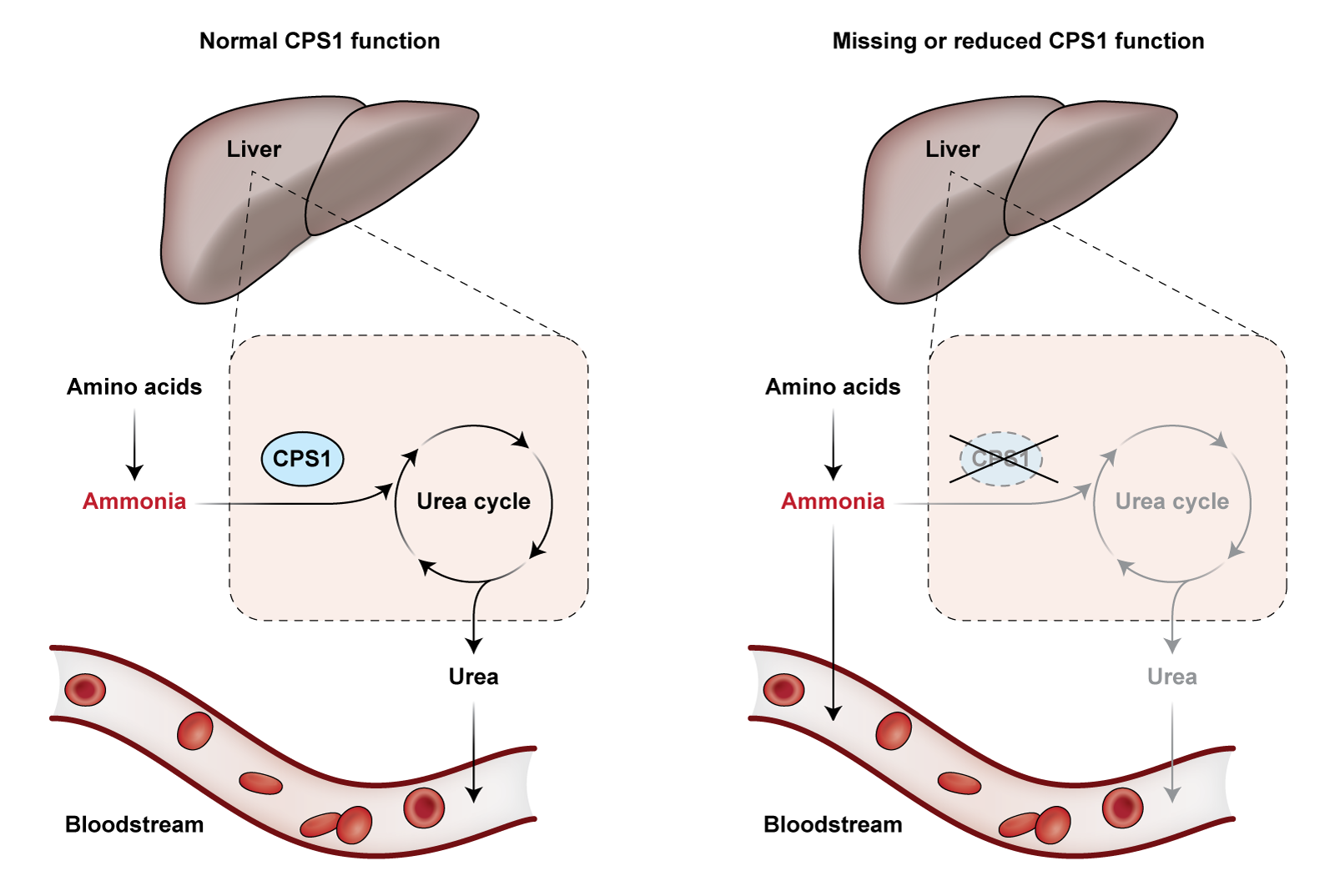 Two panels side by side:
The left panel, titled Normal CPS1 function, shows a liver at the top with a magnified section illustrating the urea cycle. Amino acids are broken down, producing ammonia highlighted in red. CPS1, depicted as a blue oval, initiates the urea cycle, which converts ammonia into urea.
Urea is then released into the bloodstream, represented by a blood vessel containing red blood cells.
The right Panel, titled Missing or reduced CPS1 function, shows the same liver at the top with a magnified section illustrating the urea cycle, but with CPS1 crossed out and the urea cycle faded. Ammonia, in red, has an arrow pointing into the bloodstream without being converted into urea. The blood vessel again shows red blood cells.