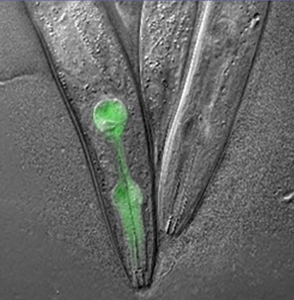Microscopic images of three worm heads, one of which fluoresces green.