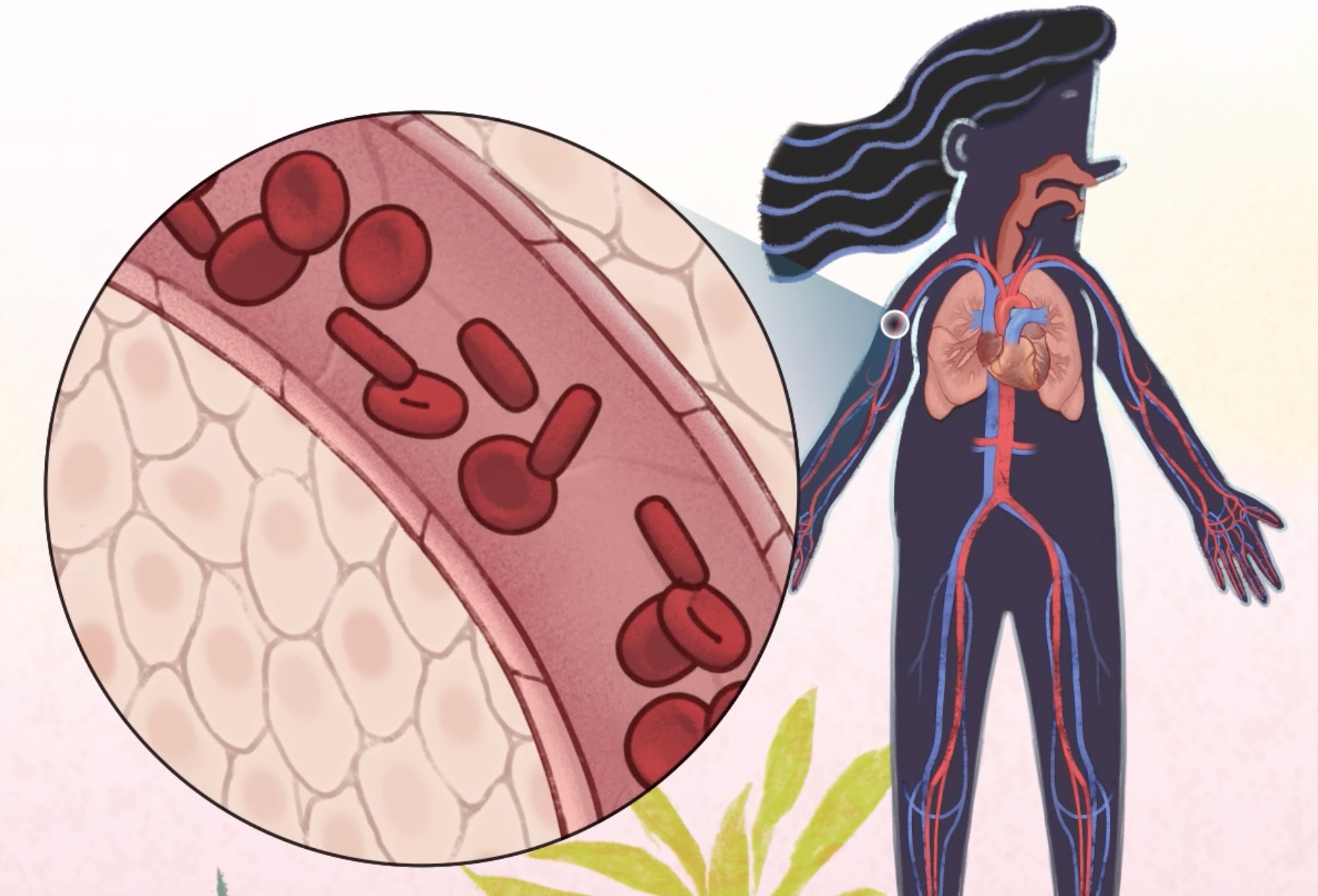 Ilustración de una sección transversal de una mujer donde se muestran los órganos internos y los vasos sanguíneos. Un acercamiento muestra a los glóbulos rojos viajando por el torrente sanguíneo.