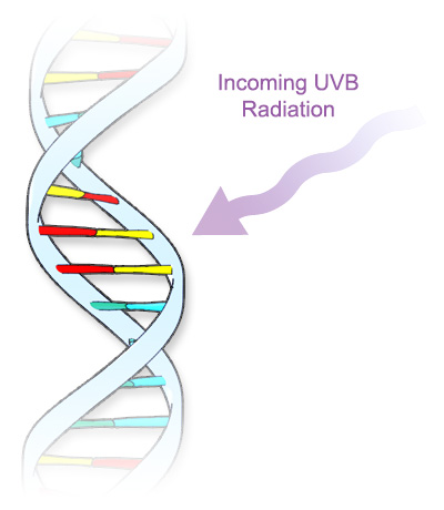 A wavy arrow pointing to a DNA double helix labeled 'Incoming UVB Radiation'.