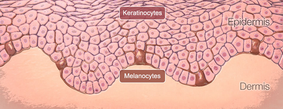 A cross section showing the Epidermis layer made up of Keratinocytes, shown as interlocking irregular round shapes with pink circular centers, and Melanocytes shown as dark branches inbetween and under the keratinocytes.