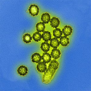 A microscopic view of a virus
