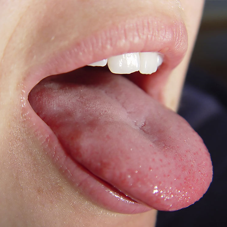 An open mouth with outstretched tongue.