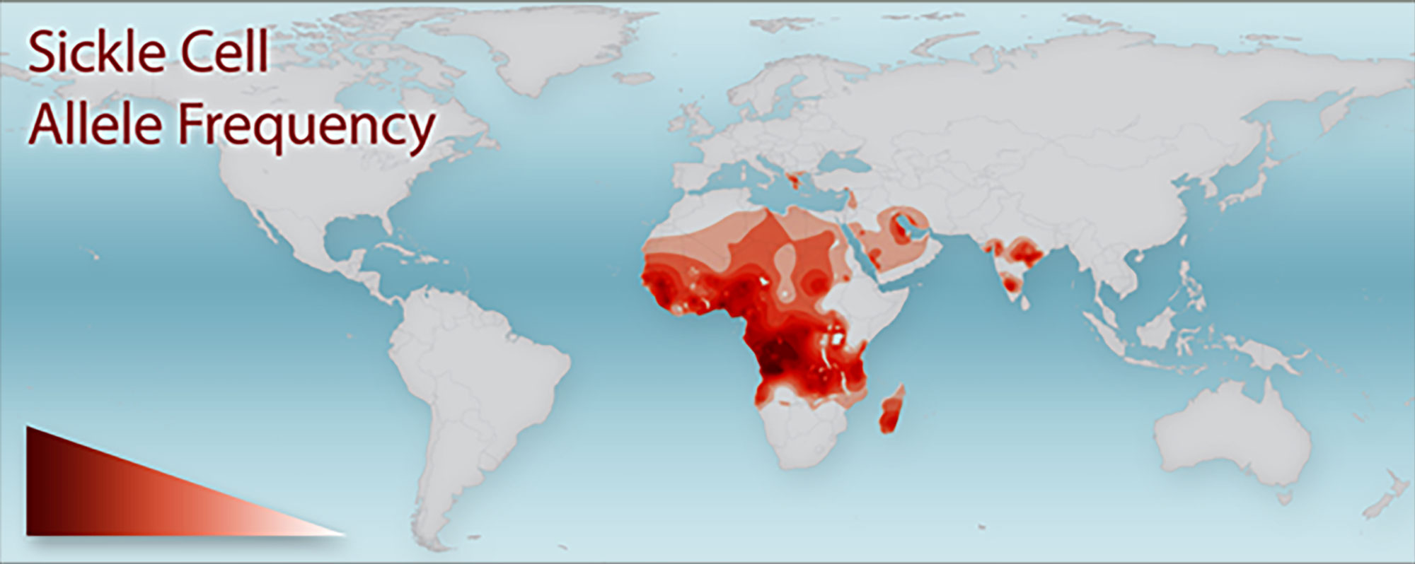 A heat map of the globe labeled Sickle Cell Allele Frequency indicating that the allele is highly concentrated in Africa, the Middle East, and India.