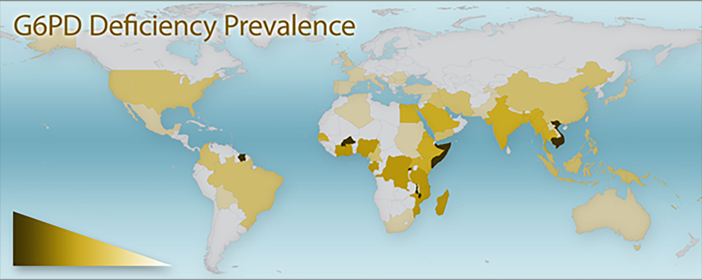 A heat map of the globe labeled G-6-P-D Deficiency Prevalence indicating that the deficiency is highly concentrated in Africa, the Middle East, India, and Asia and is generally less prevalent in the Americas.