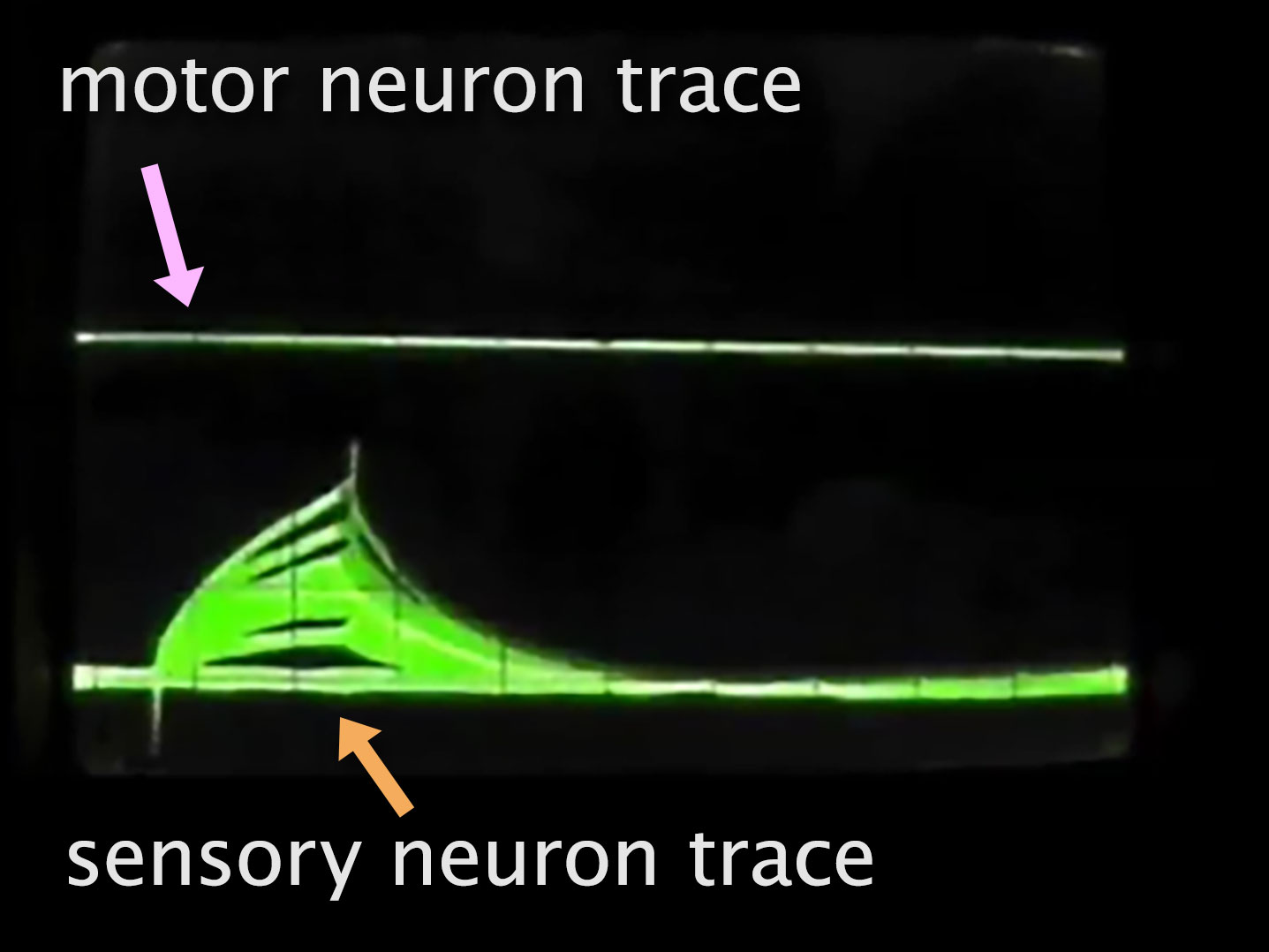 Dual electrical activity graph of sensory and motor neurons.