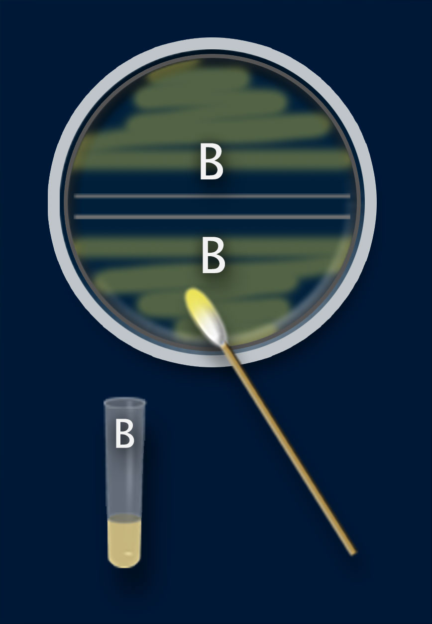 A dish with both halves marked B, a swab, and a test tube marked B. There is no bioluminescence.