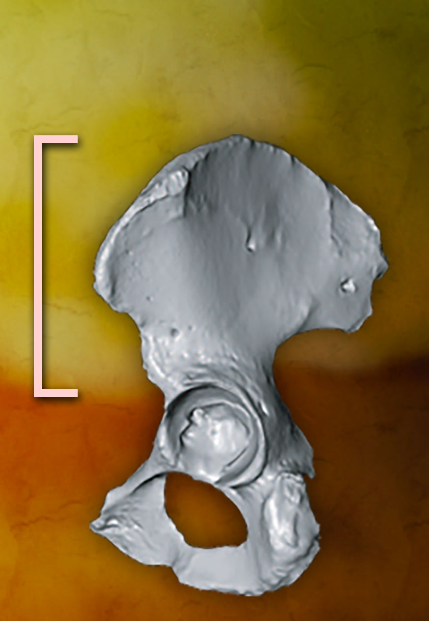 A side view of a human pelvis with a bracket marking the length of the ilium.
