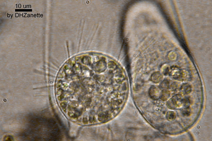 A closeup of two protozoa