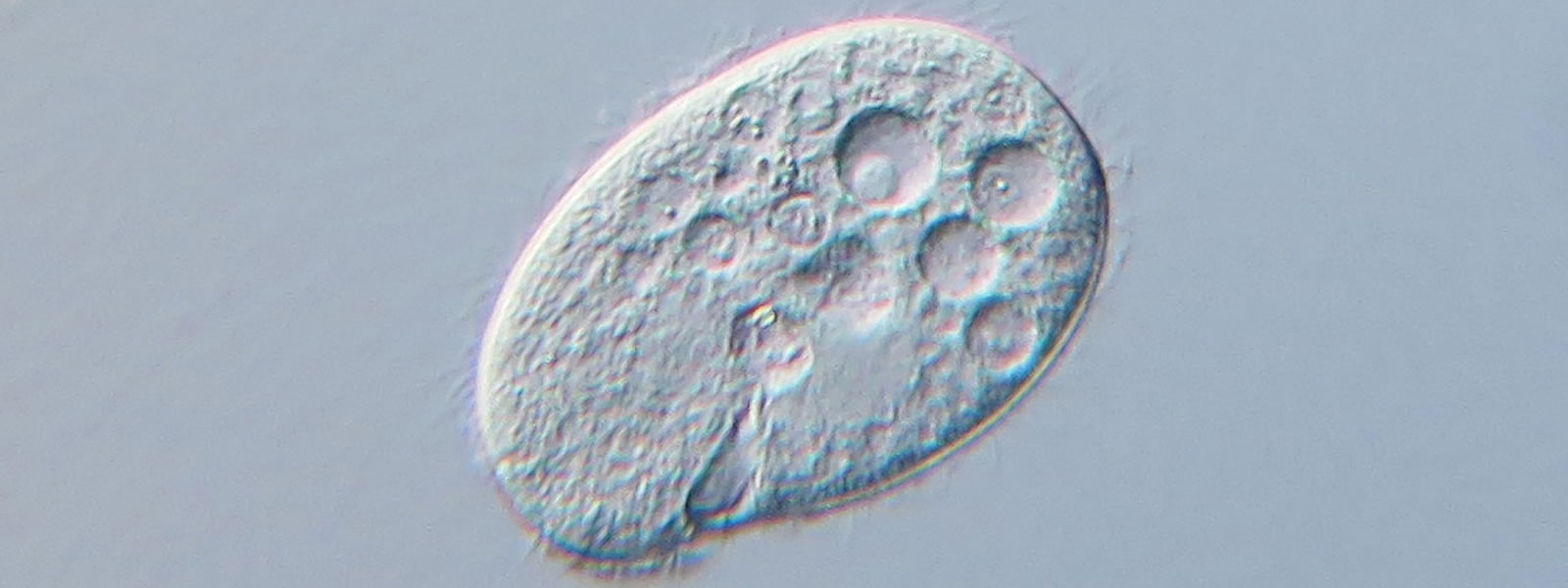 A closeup of a protozoon, which is pock marked and oval shaped