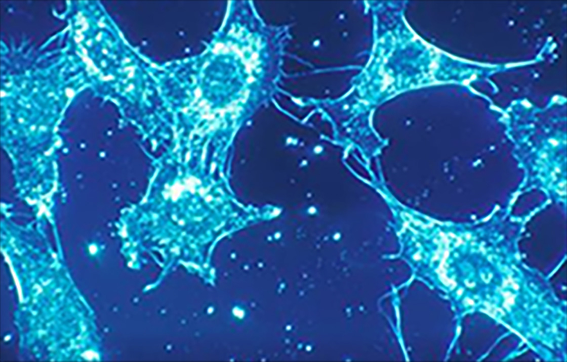 MIcroscopic image of blue stained transparent irregular shapes.