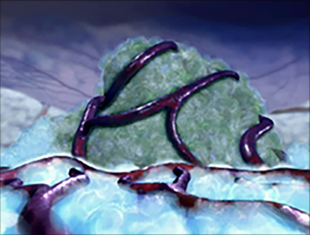 An irregular mass of cells with blood vessels.