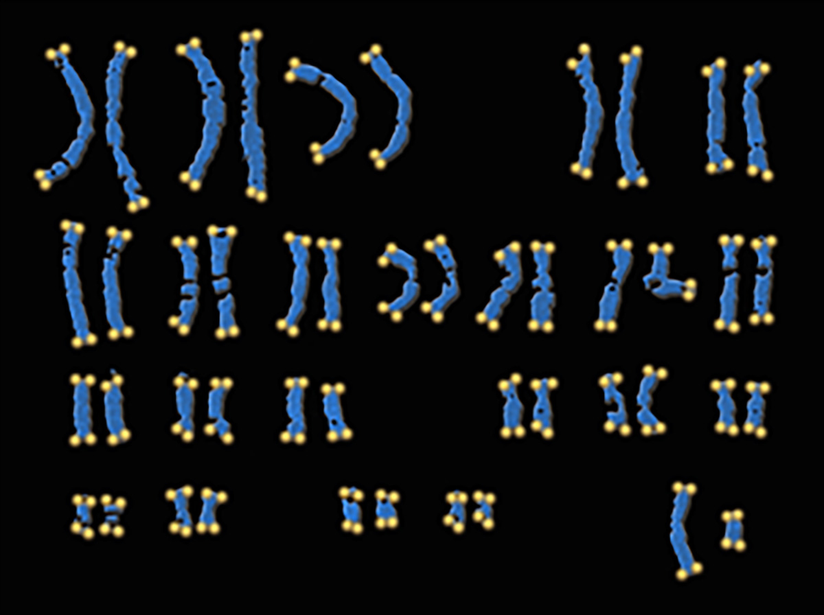 A full set of blue chromosomes of different sizes with yellow ends.