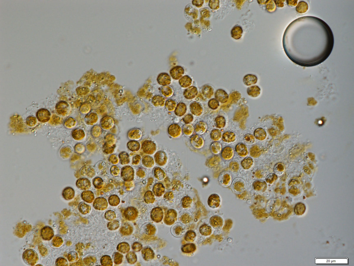 A photograph taken using a light microscope of over two dozen zooxanthellae, which appear as light-brown, translucent circles on a gray background.