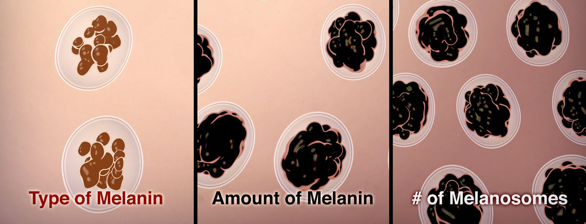 Three panels show illustrations for type of melanin, amount of melanin and number of melanosomes