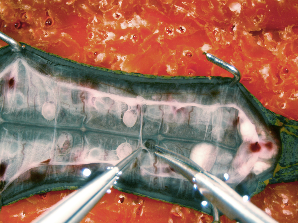 A close-up of the cut-open leech in the dissection dish. Forceps and scissors are being used to remove the leech's internal organs.
