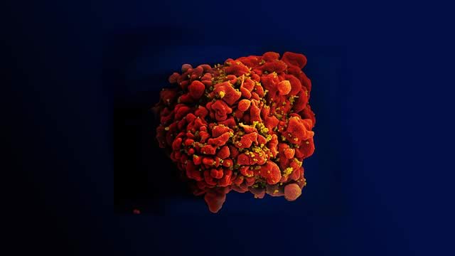 A t-cell is covered with small bright particles